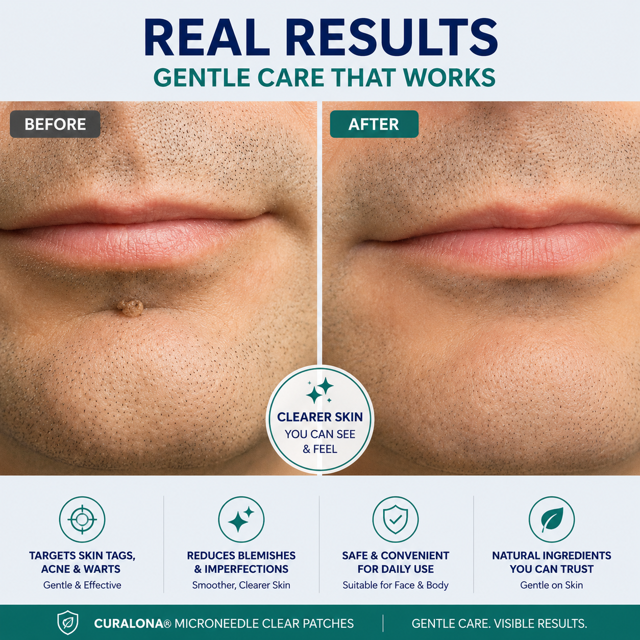 Curalona™ Skin Renewal Patch
