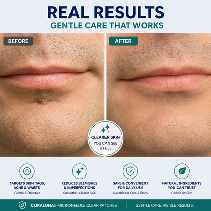 Curalona™ Skin Renewal Patch