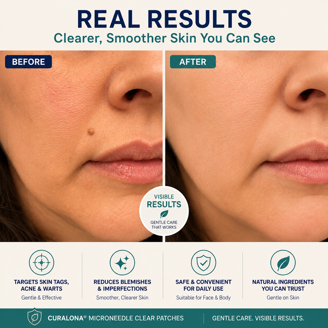 Curalona™ Skin Renewal Patch