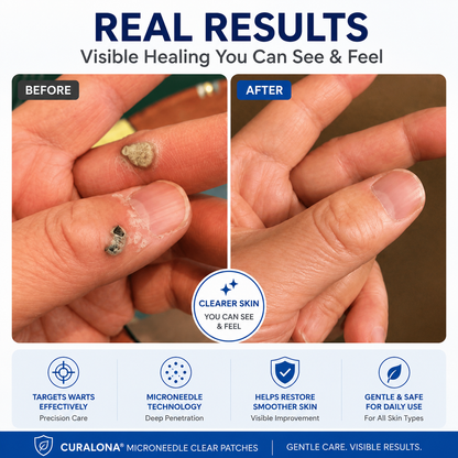 Curalona™ Skin Renewal Patch